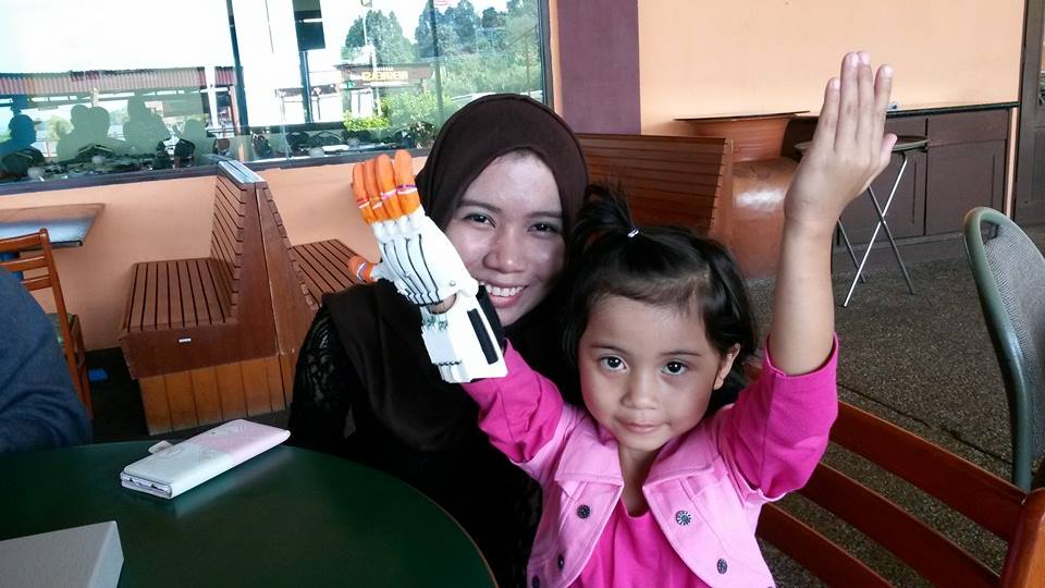 Ainaa Amanda Shahzali Dapat Sumbangan Tangan Bionik Mynewshub