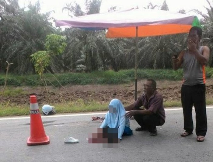 Pelajar-Hilang-Kaki-Dilanggar-Lori1