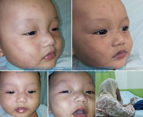 Hari Pertama Hantar Ke Pengasuh, Ibu Terkejut Bayi Didera 