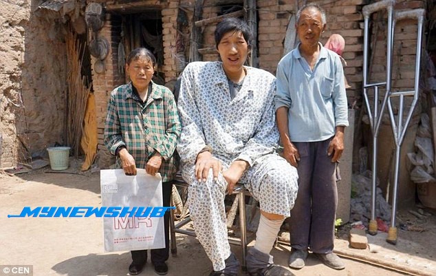 Lelaki Miliki Ketinggian 7' 11" Bakal Jalani Pembedahan