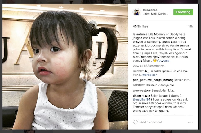 Awal, Scha Al-Yahya Mohon Jangan Cium Lara Alana