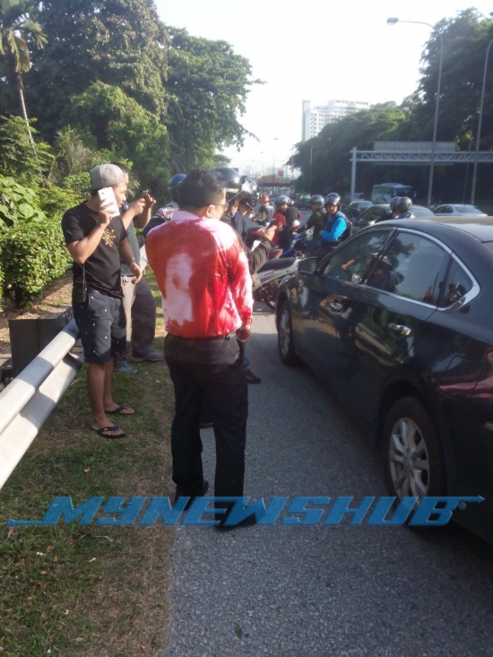Lelaki Dibedil Lima Das Tembakan Di Highway Sg. Besi