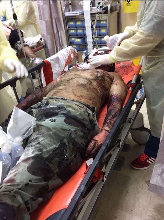 3 Letupan Di Arab Saudi, 1 Di Luar Masjid Nabawi