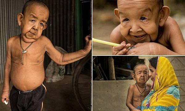 Wajah Budak 4 Tahun Seperti Wajah Datuk 80 Tahun