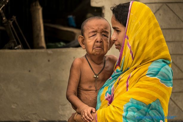 Wajah Budak 4 Tahun Seperti Wajah Datuk 80 Tahun