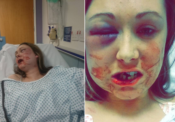 Tak Nak Buat Seks, Wanita Dedah Gambar Dibelasah BF