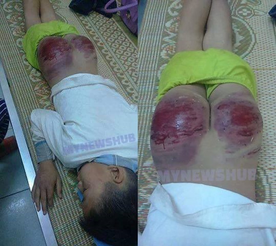 Apa Dosa Disebat Punggung Budak Sampai Macam Ini?