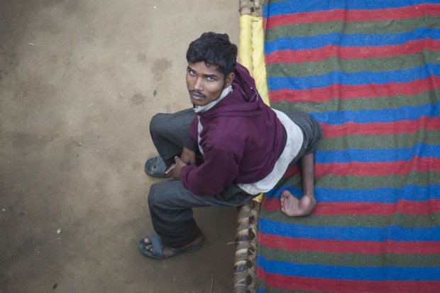 *** EXCLUSIVE - VIDEO AVAILABLE *** FARRUKHABAD, INDIA - DECEMBER 09: Arun Kumar Rajput poses for a photograph at his house on December 09, 2015 in Farrukhabad, India. A YOUNG man with FOUR legs appealed to doctors to amputate his two extra limbs. Arun Kumar, 22, was born with two extra legs growing from his lower back - one underdeveloped and the other permanently bent at the knee. After living for 15 years without any kind of treatment, Arun, from Uttar Pradesh, India, appealed through social media for medical help to remove his extra legs. A team of specialists at Fortis Hospital in Delhi responded to ArunÃ­s plea for help and organised a series of tests to find out how the legs are attached and if he can be treated. **CONDITION OF USAGE: The following plug must be used in print and/or online: Arun's story appears in Body Bizarre, Thursday November 3, 10pm, on TLCÃ® credit: TLC/ Barcroft Productions** PHOTOGRAPH BY Arkaprava Ghosh / Barcroft Images London-T:+44 207 033 1031 E:hello@barcroftmedia.com New York-T:+1 212 796 2458 E:hello@barcroftusa.com New Delhi-T:+91 11 4053 2429 E:hello@barcroftindia.com www.barcroftimages.com