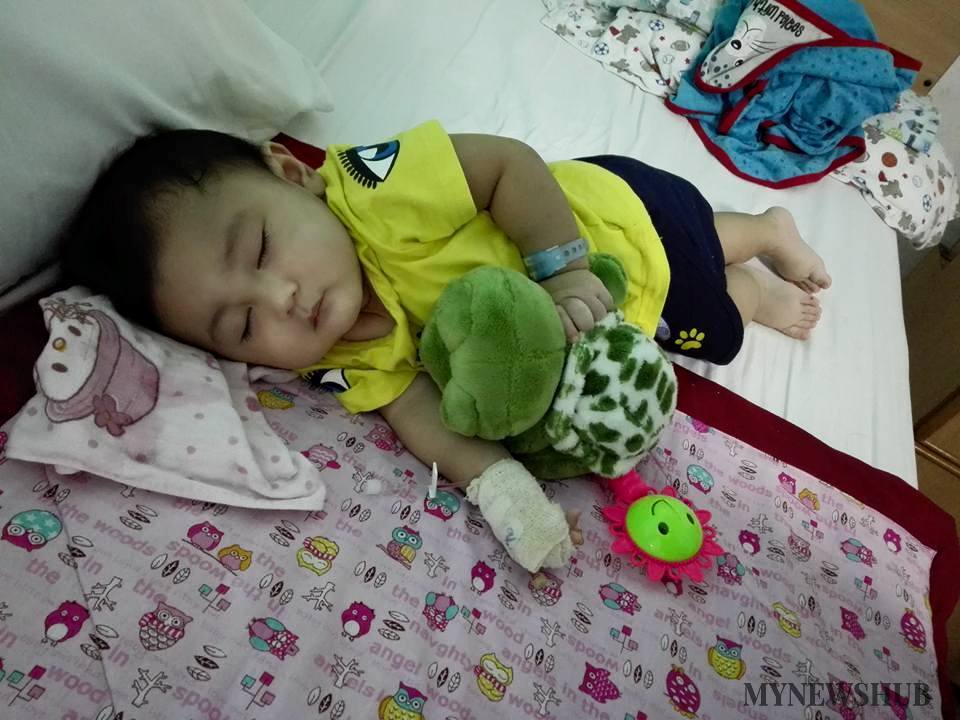 Bayi Alami Pendarahan Luar Otak, Jatuh Di Rumah Pengasuh
