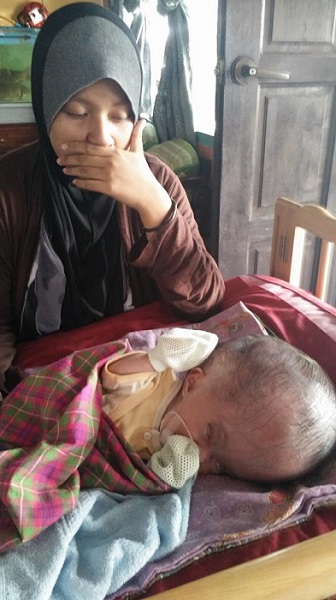 Bayi Perempuan Kepala Besar Perlukan Bantuan