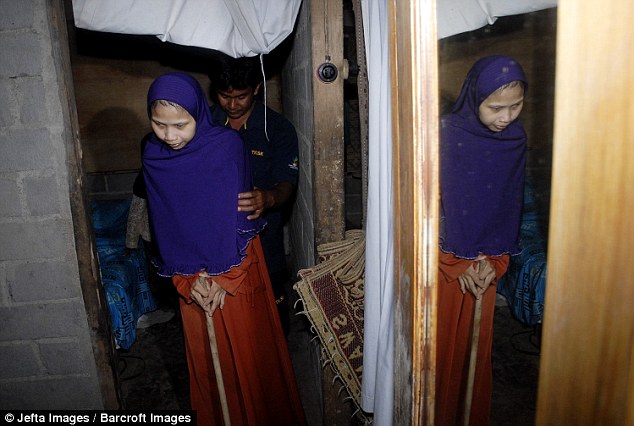 Badan Wanita Ini Jadi Kaku, Digelar Manusia Kayu