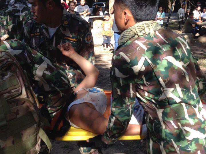 Nak Swafoto, Pelancong Perancis Digigit Buaya