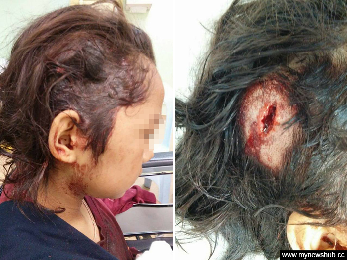 Pelajar 13 Tahun Dibuli Sampai 'Bocor' Kepala