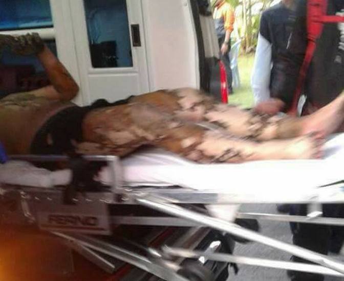 Seorang Melecur Teruk Dalam Kebakaran Kilang