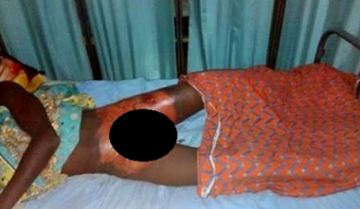 Suami Isteri Bakar Kemaluan Remaja Rogol Anaknya