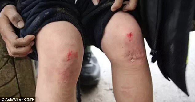 Budak Lelaki Nekad Minta Kebenaran Guru Sebelum Dirawat