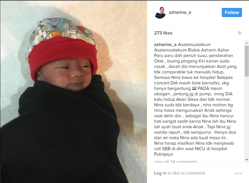 Anak Angkat Kedua Azharina Kritikal