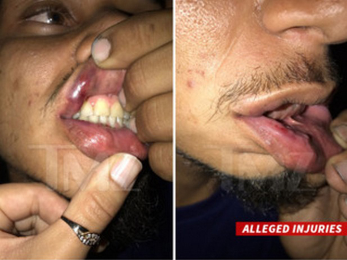 Tumbuk Jurugambar, Chris Brown Bakal Didakwa