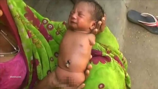 Tetap Terima Walaupun Anak Tanpa Kaki, Tangan