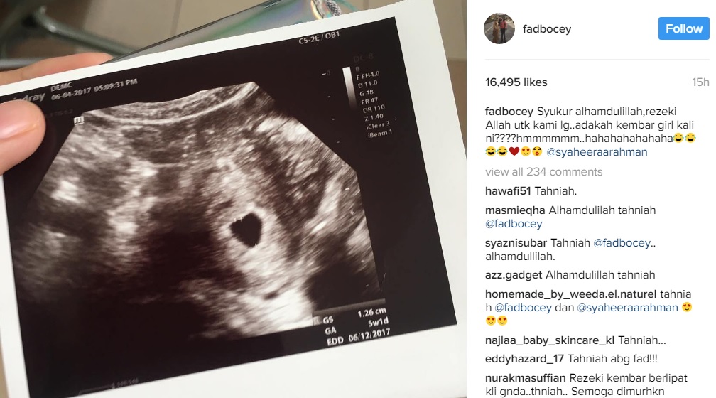 Isteri Hamil Lagi, Fad Idam Kembar Perempuan Pula