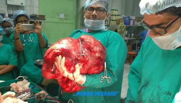 Dikurung Setahun Disangka Kena Sampuk Hantu