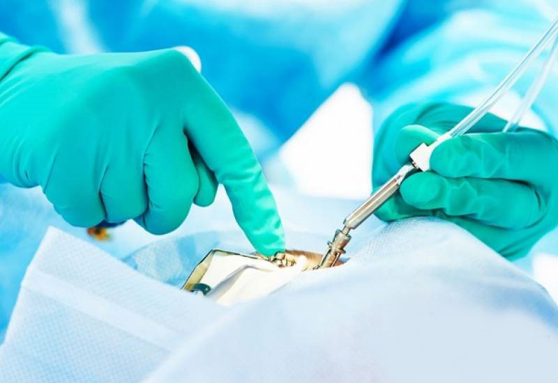 Rawatan Katarak Di Hospital Labuan Tahun Depan - MYNEWSHUB