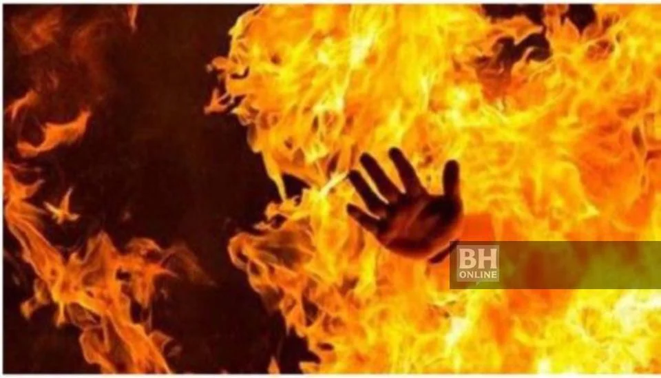 Remaja Parah Melecur Dibakar Rakan