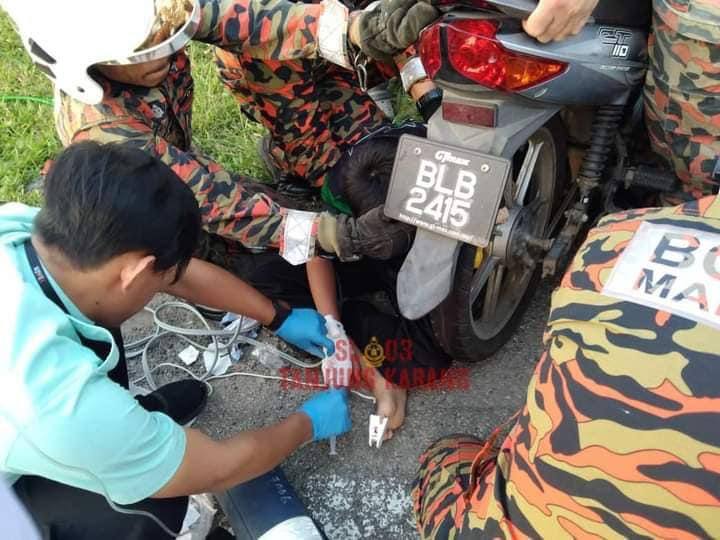 Lengan Kanak-Kanak Hampir Putus Tersepit Rantai Motosikal
