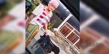 Lima Cedera Diserang Rottweiler: Polis Sudah Ambil Keterangan Pemilik Anjing