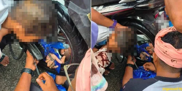 Kanak-kanak Cedera Tangan Kiri Tersepit Rim Motosikal