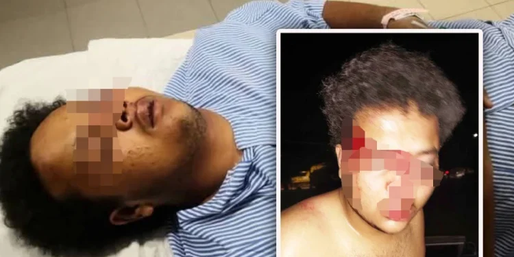 Silap Identiti, Pelajar Tingkatan 5 Parah Dibelasah Beramai-Ramai