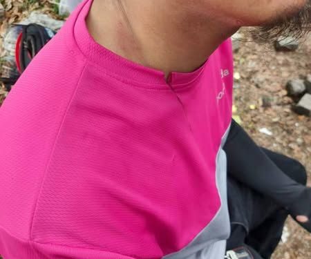 Bahaya Kabel Halus di Laluan Kampung Puyut, Rider Cedera Ringan