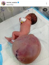 a baby with a large round object