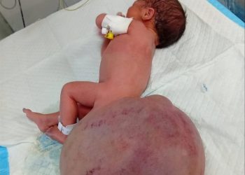 Bayi Gaza Lahir Dengan Kanser Pelik: Senjata Israel Dipercayai Puncanya