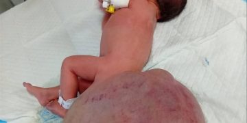 Bayi Gaza Lahir Dengan Kanser Pelik: Senjata Israel Dipercayai Puncanya