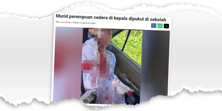 Kecederaan Murid Berpunca Kemalangan Ketika Bermain – Guru Besar