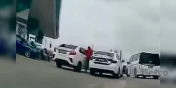 Pemandu E-hailing Cedera Di Muka, Dipukul Dengan Pengunci Stereng