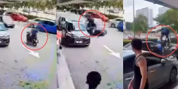 Remaja 17 Tahun Patah Tangan Motosikal Ditunggang Lawan Arus Bertembung Kereta